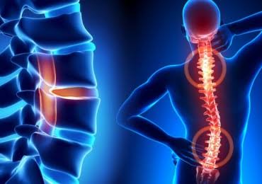 Безоперационное роботизированное лечение грыж поясницы и шеи